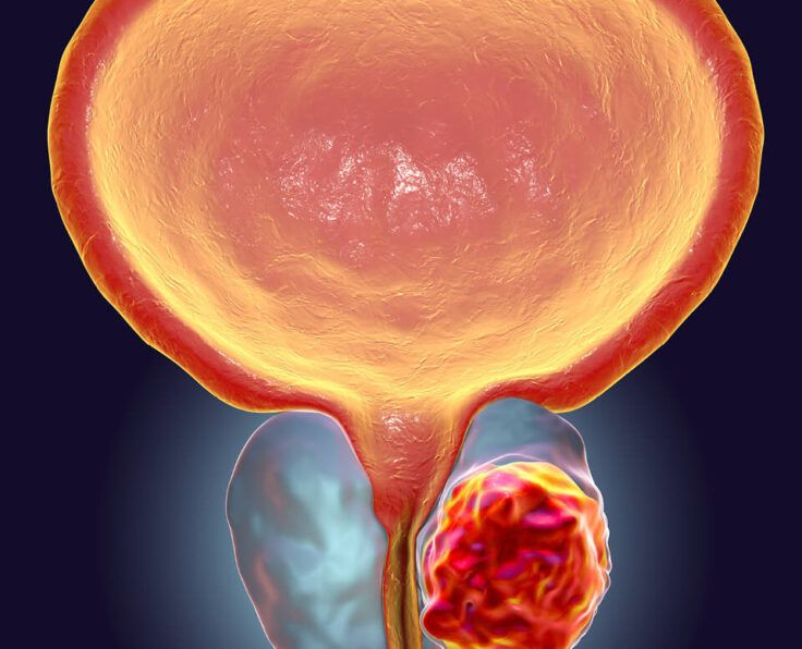 prostate